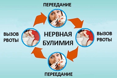 Лечение булимии в Павлово